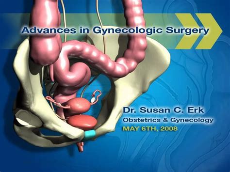 Ppt Focus Hysterectomy Powerpoint Presentation Free Download Id