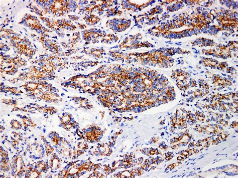 Amacr P S For Ivd Ihc Pathology Usciencecorp