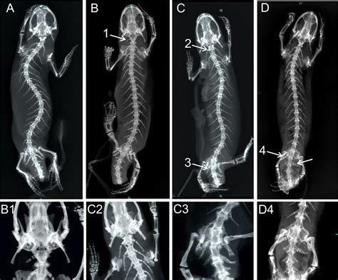 X Ray Images Of Homeotic Transformations Recorded A Complete