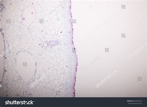 Collenchyma Tissue Plant Under Microscope Stock Photo 463657871 ...