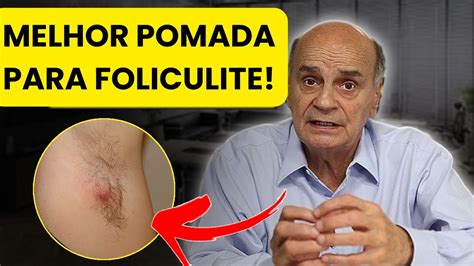 Qual Pomada Usar Para Tirar Foliculite Melhor Op O Youtube