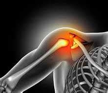 ROTATOR CUFF SURGERY – CSF Surgery