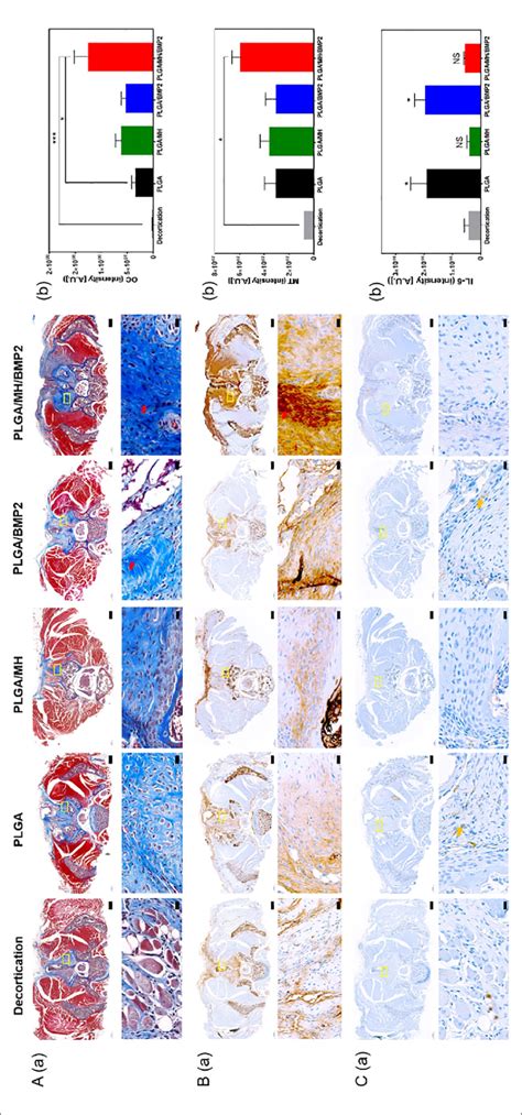 Masson S Trichrome Staining And Immunohistochemistry Of The Spinal