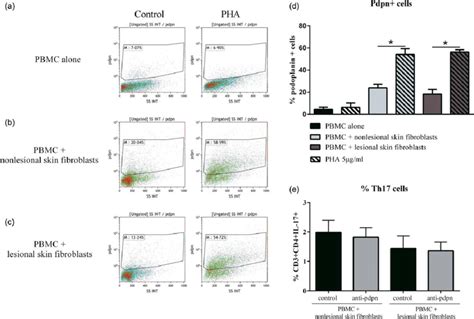 Expression Of Podoplanin Pdpn In Peripheral Blood Mononuclear Cells