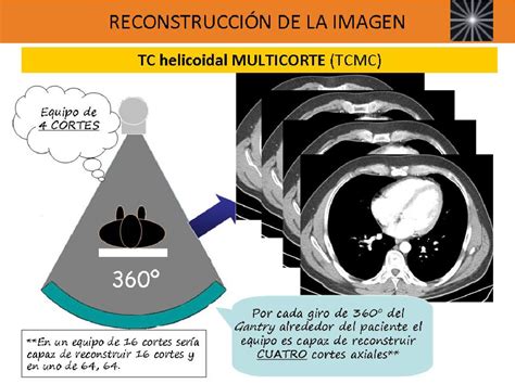 Figure 13 From Desentrañando La Tecnología De La Tomografía