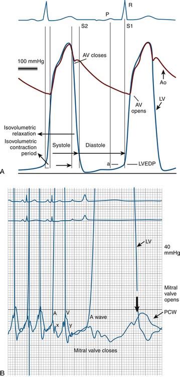 Hemodynamic Data And Basic Electrocardiography Thoracic Key