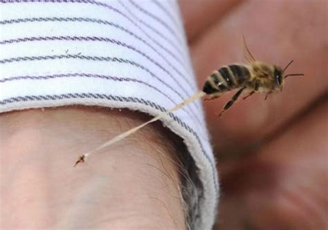 Esto Es Lo Que Debes Hacer Si Te Pica Una Abeja O Una Avispa El