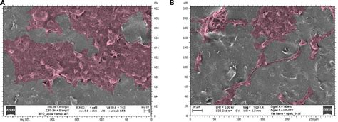 Frontiers Ultrasonication Effects On Graphene Composites In Neural