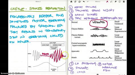 Cheyne Stokes Respirations Are Described as a