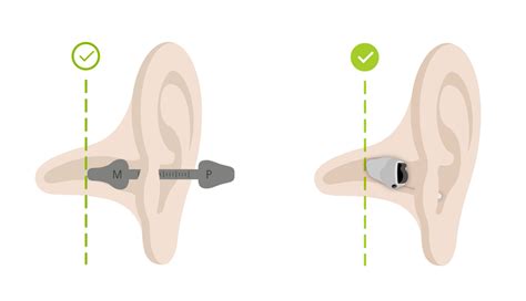 Press About The New Phonak Virto™ B Titanium Hearing Aid Phonak