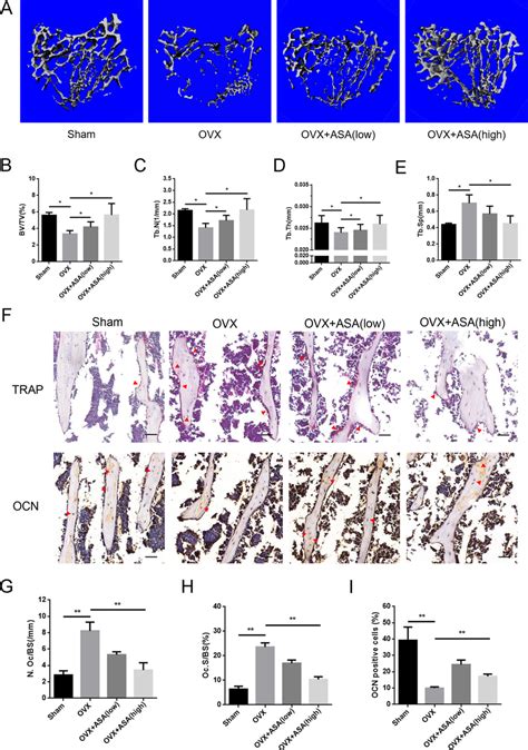 Aspirin Prevented Ovx Induced Bone Loss In Vivo A Representative