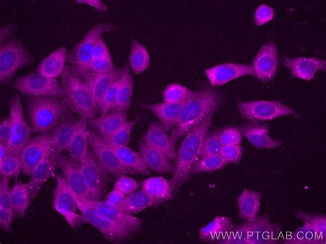 Vdac Porin Antibody Cl Proteintech