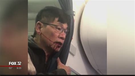 Settlement Reached Between Dr David Dao United Airlines Fox 9