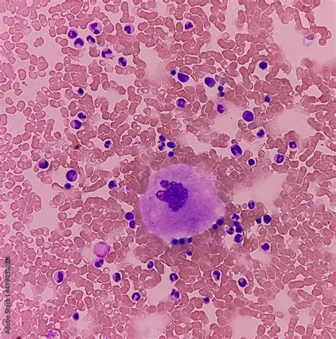 Megakaryocyte In Bone Marrow