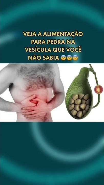 Alimentação Pedra Na Vesicula - Alimentação ideal para pedra na vesícula que você não sabia 😨😨 - YouTube
