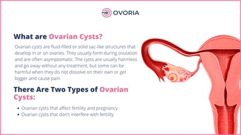 Ovarian Cysts During Pregnancy Types Symptoms Treatments Off