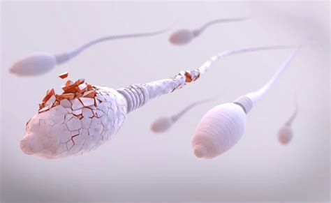 Sperm DNA Fragmentation: Causes, Symptoms and Treatments