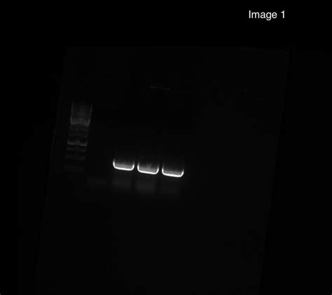 Image 1 Shows Raw Data Of Gel Electrophoresis Labelannotate Image 1 Lanes Ladder Sizes Etc