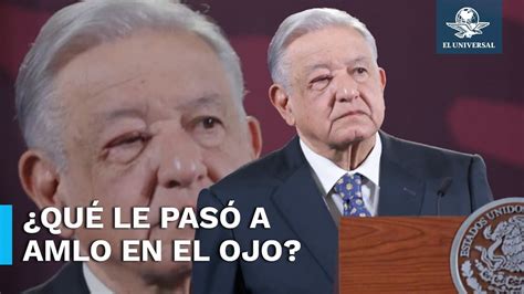 AMLO aparece con el ojo hinchado en La Mañanera esto dijo YouTube