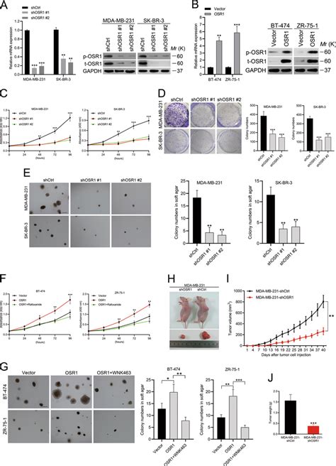 Osr1 Enhances The Proliferation Of Breast Cancer Cells In Vitro And In