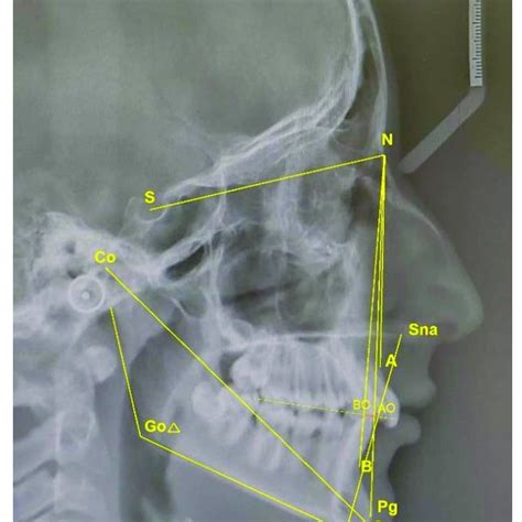 The Angular And Linear Skeletal Measurements Download Scientific Diagram