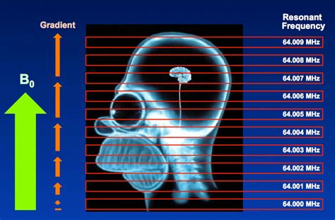 Frequency Encoding Questions And Answers In Mri