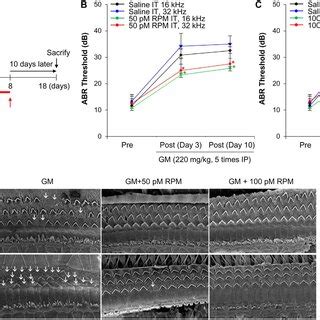 The Autophagy Inducer RPM Enhances Autophagic Flux In Auditory Cells