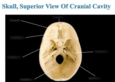 Skull Superior View Of Cranial Cavity Diagram Quizlet