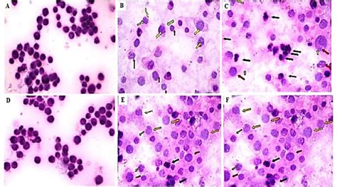 Microscopic examination of histological alterations induced in Caco-2 ... 