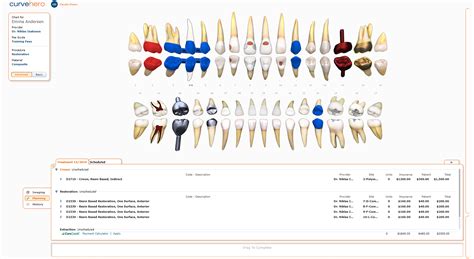 Dental Charting Software | Curve Dental