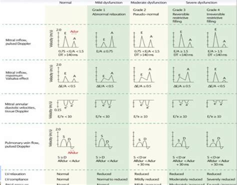 Diastolic dysfunction grades (Natarajan et al., 2013) | Download ...