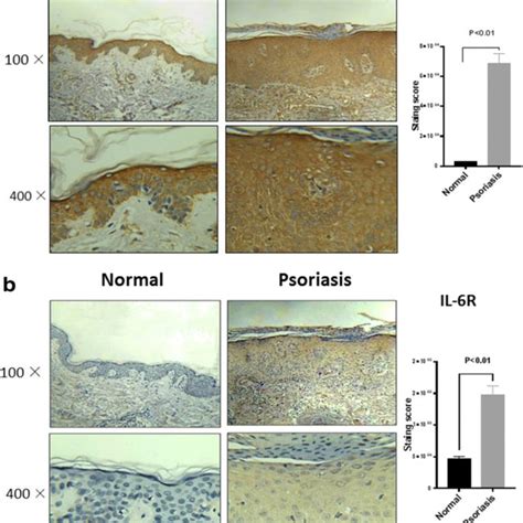 Immunochemical Staining For Membrane Bound IL 6R And Gp130 In Skin