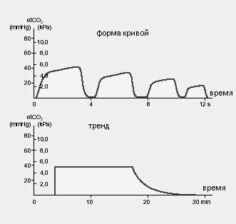 Анализ капнограмм.