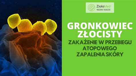 Gronkowiec Z Ocisty Zaka Enie U Os B Z Atopowym Zapaleniem Sk Ry Jak