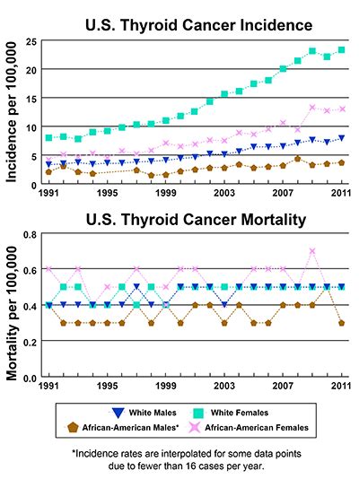 A Snapshot Of Thyroid Cancer National Cancer Institute