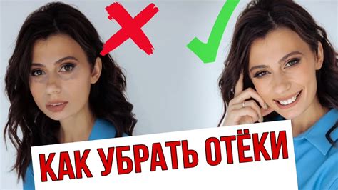 7 ПРИЧИН ОТЁКОВ, о которых Вы ДОЛЖНЫ ЗНАТЬ - YouTube