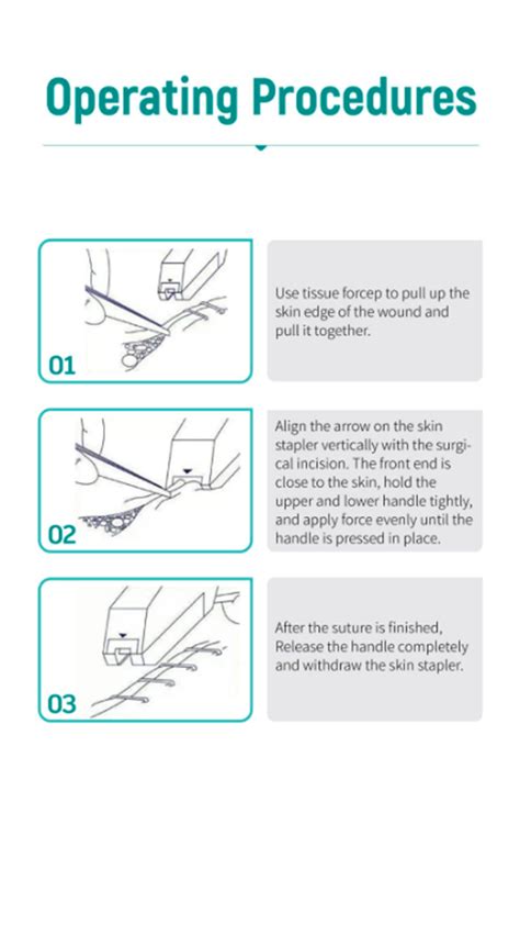 Απλό συρραπτικό Δέρματος Skin Stapler PetLine A World For Pets