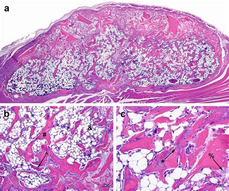 Representative H E Staining Of Explants From An Athymic Nude Mouse