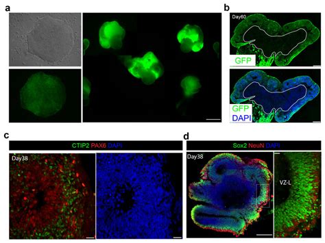 Generation And Characterization Of Gfp Cerebral Organoids A