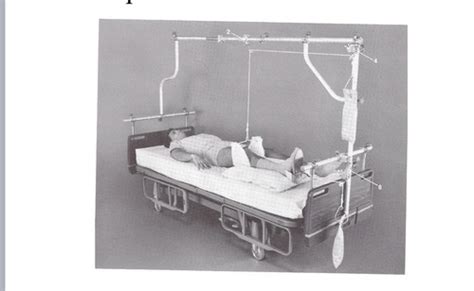 Traction Flashcards | Quizlet 