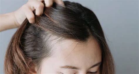 How To Deal With Postpartum Hair Loss Tribeca Salons