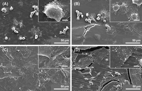 Scanning Electron Micrographs Of Osteoblast Like Cells Saos