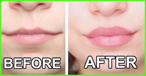 21 Best Lip Plumpers That Make Your Lips Appear Bigger 2022