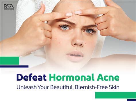 Hormonal Acne And The Best Effective Methods For Treatment