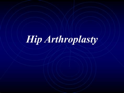 Hip Arthroplasty