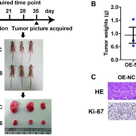 Tumor Suppressor Role Of Mettl In Pda In Vivo A Xenograft