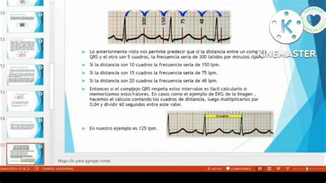 Como Calcular La Frecuencia Cardíaca En Un Electrocardiograma Youtube