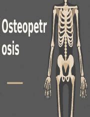 Understanding Osteopetrosis: Causes, Symptoms, and Treatment | Course Hero