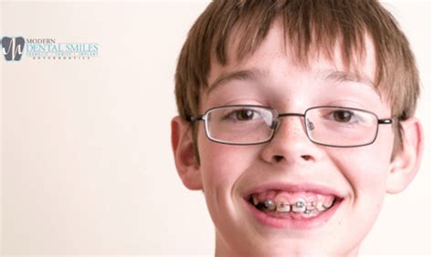 Early Orthodontics