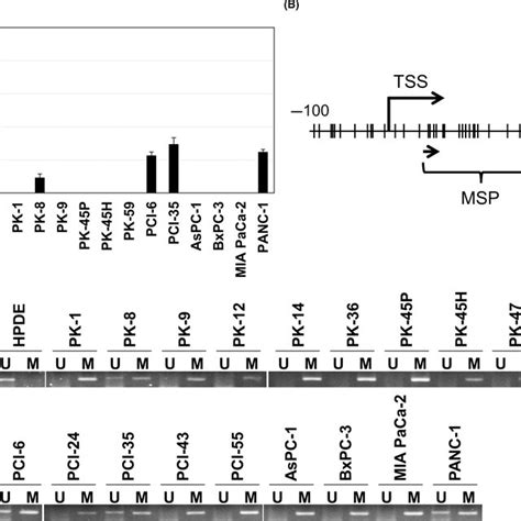 Aberrant DNA Methylation And Reduced Expression Of IRX4 In Primary